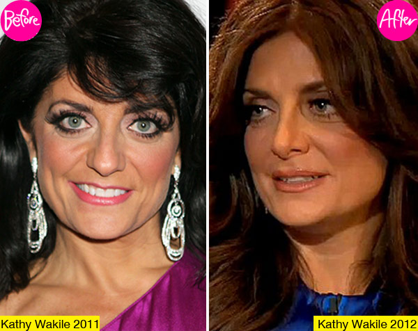 Kathy Wakile Plastic Surgery