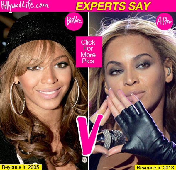 Beyonce Nose Job