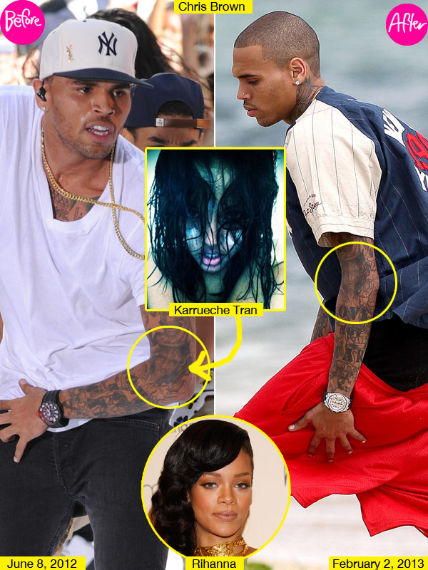 Chris Brown Tattoo Removed