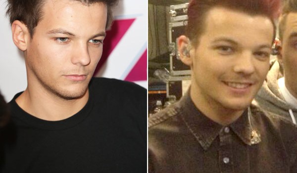 Louis Tomlinson Red Hair