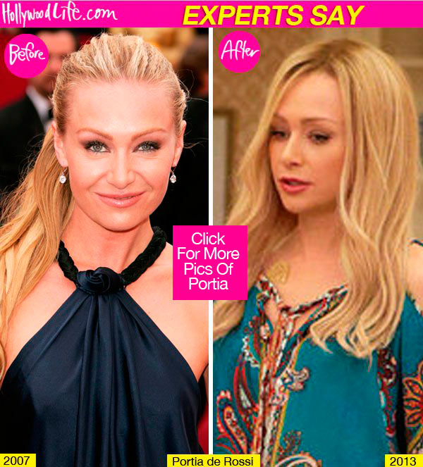 Portia De Rossi Plastic Surgery