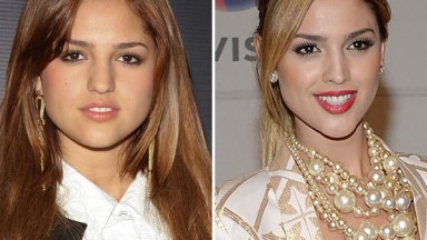 Eiza Gonzalez Plastic Surgery