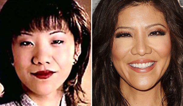 Julie Chen Plastic Surgery