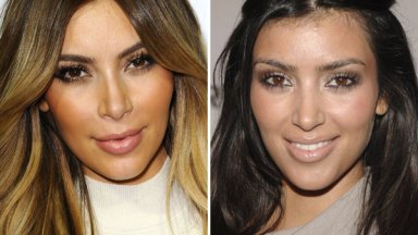 Kim Kardashian Botox