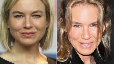 Renee Zellweger Face