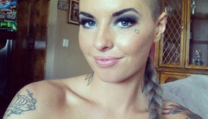 Christy Mack Recovery Facial Reconstruction