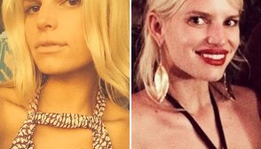 Jessica Simpson Lip Fillers