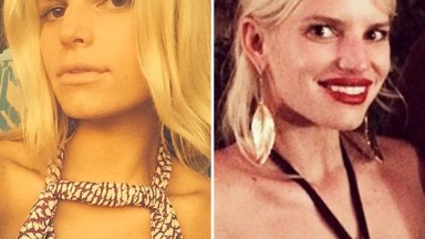Jessica Simpson Lip Fillers