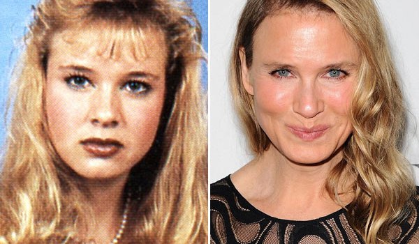 renee zellweger before after