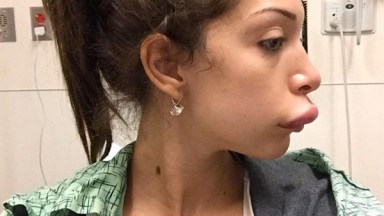 Farrah Abraham Botched Surgery