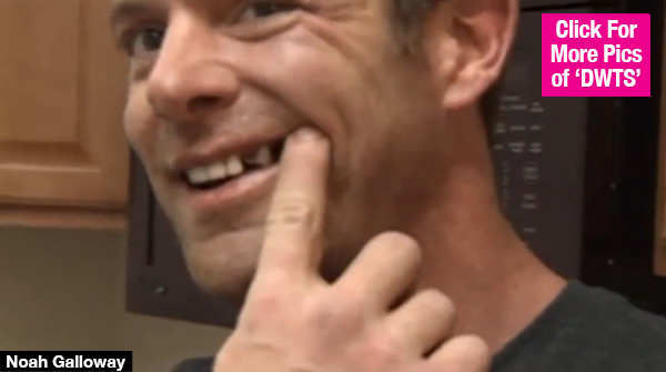 DWTS Noah Galloway Tooth Kicked