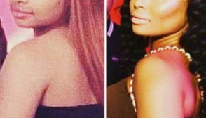 Blac Chyna Plastic Surgery