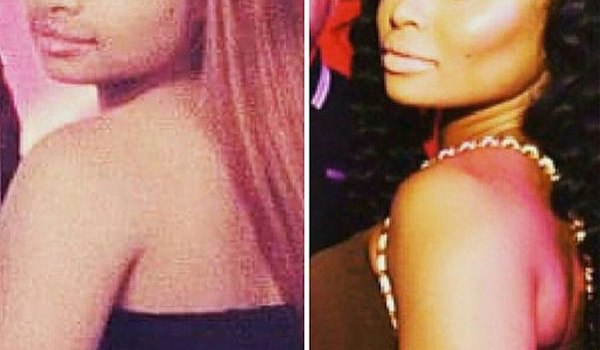 Blac Chyna Plastic Surgery