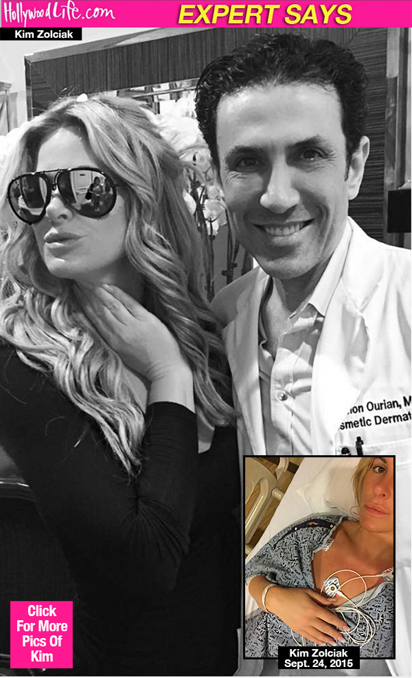 Kim Zolciak Botox