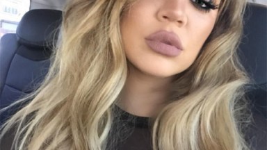 Khloe Kardashian Fillers