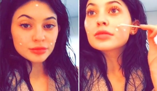 Kylie Jenner Pimple Cream