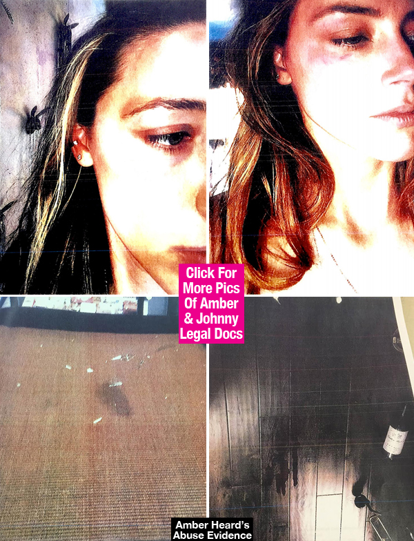 Amber Heard Johnny Depp Abuse Evidence