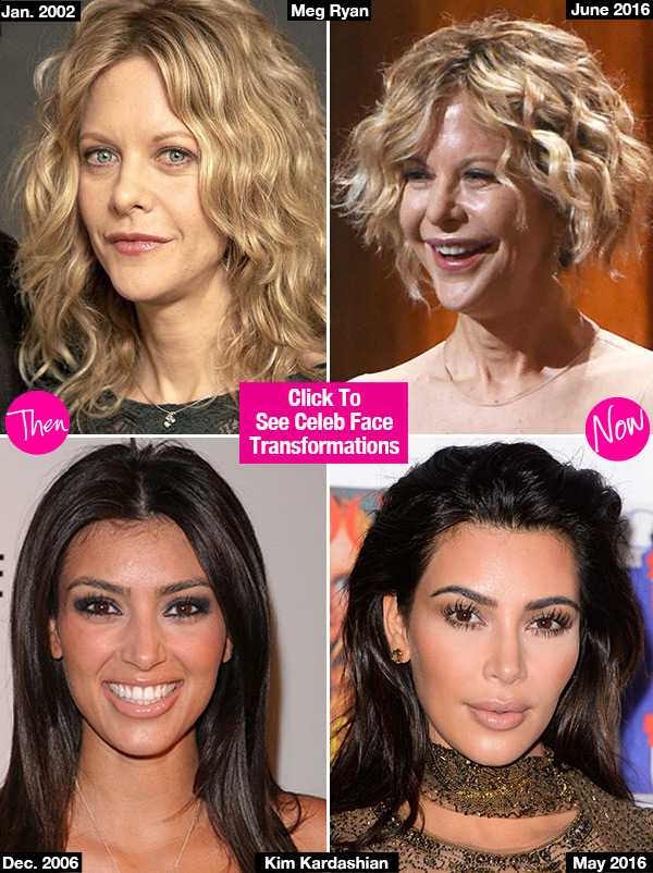 Celebrities Whose Faces Changed