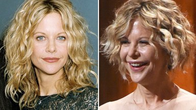 Meg Ryan Plastic Surgery