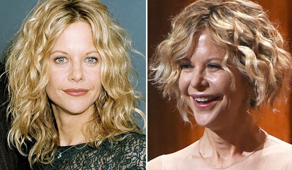 Meg Ryan Plastic Surgery