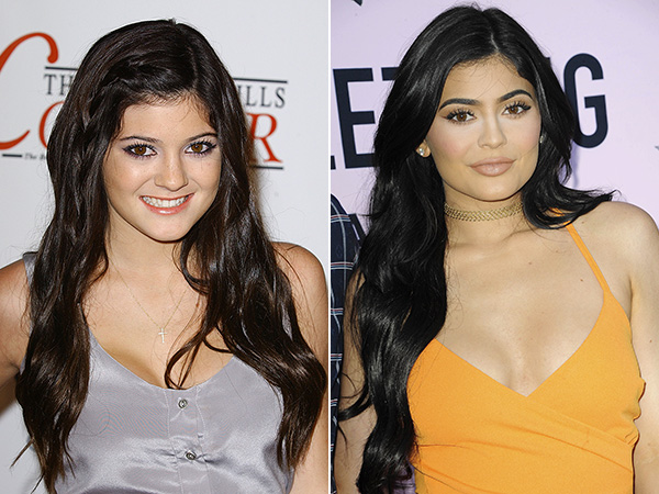 kylie-jenner-face-remake