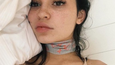 Kylie Jenner Freckles