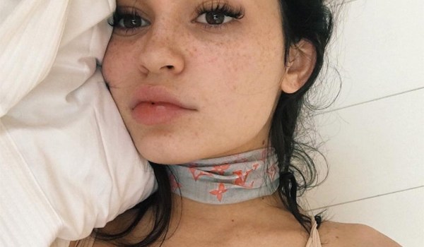 Kylie Jenner Freckles