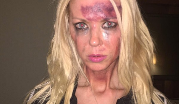 Tara Reid Bruised Face