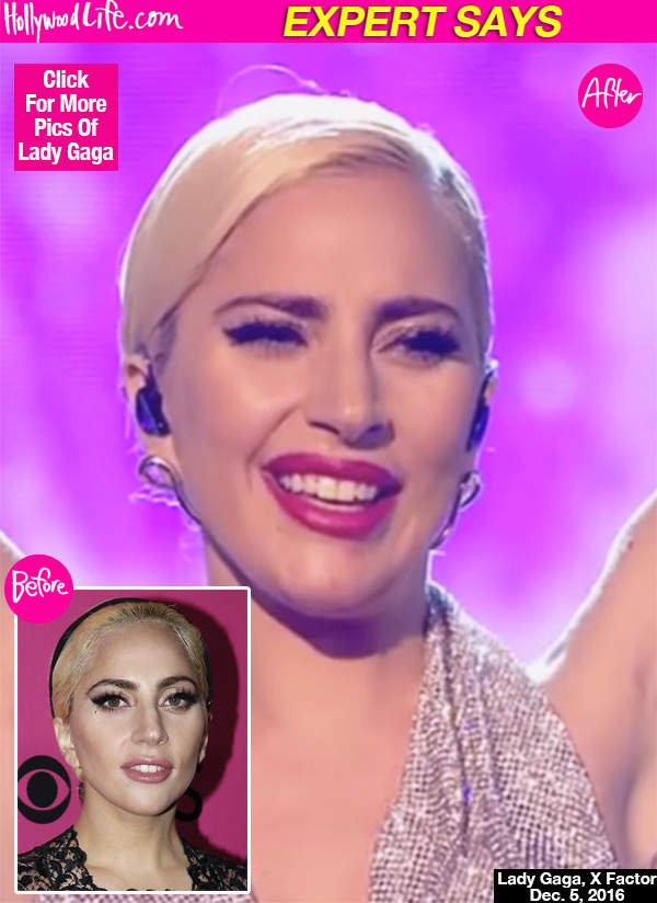 Lady Gaga Nose Job