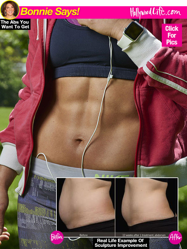 Does Sculpsure Work?