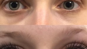 Do Eyelash Extensions Damage Lashes