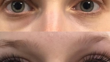 Do Eyelash Extensions Damage Lashes