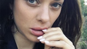 Marion Cotillard Plastic Surgery