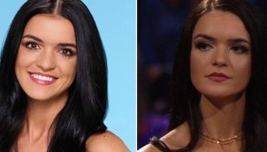 Did Raven Gates Get A Nose Job