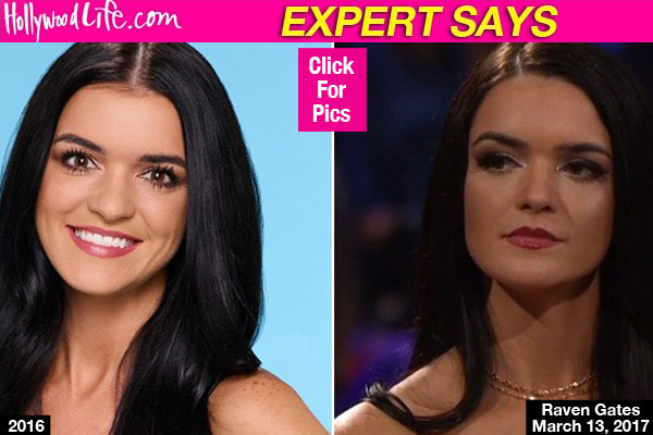 Did Raven Gates Get A Nose Job