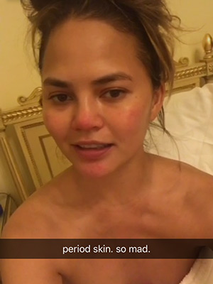 Chrissy Teigen period skin