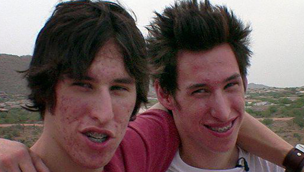 Arizona Twins Plastic Surgery Brad Pitt