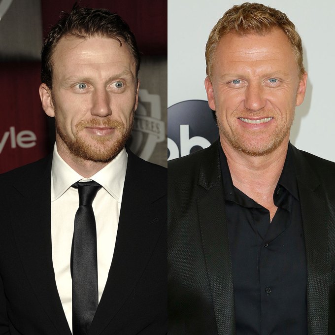 Kevin McKidd