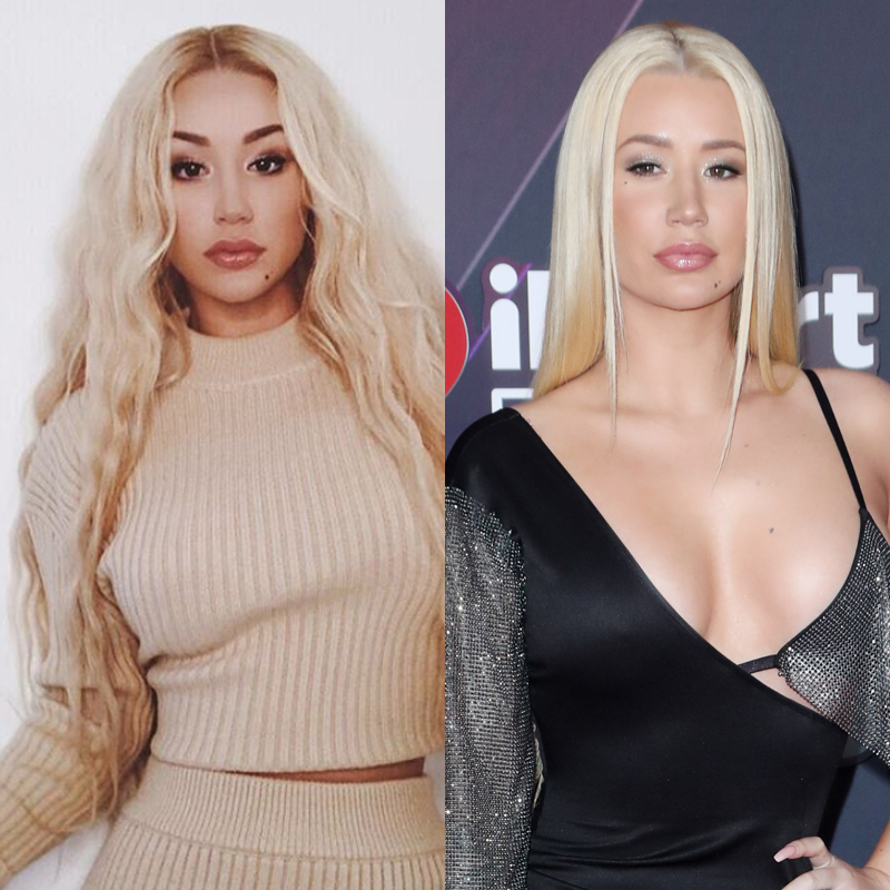 Iggy Azalea Plastic Surgery