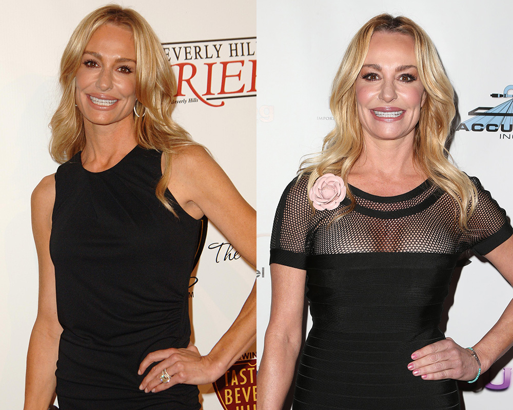 taylor-armstrong-then-now-rhobh