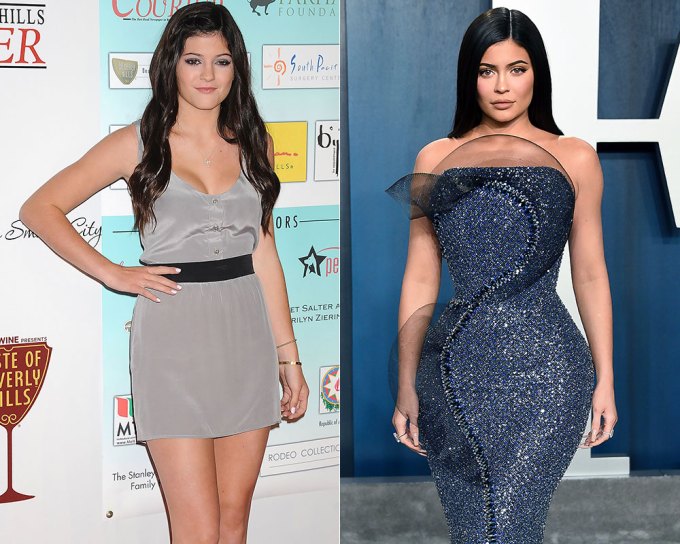 Kylie Jenner Then & Now