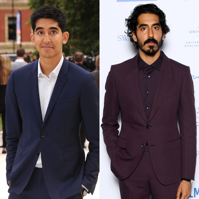 Dev Patel